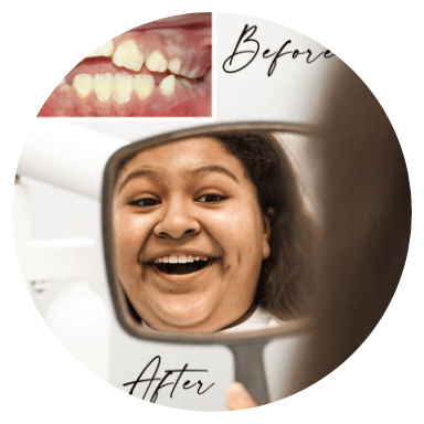 A young girl, holding a mirror and looking at her new smile. She seems excited, and is delighted with the results of orthodontic treatment.
