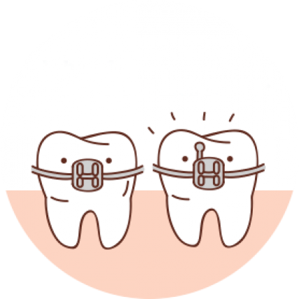 A picture of two teeth's with a brackets