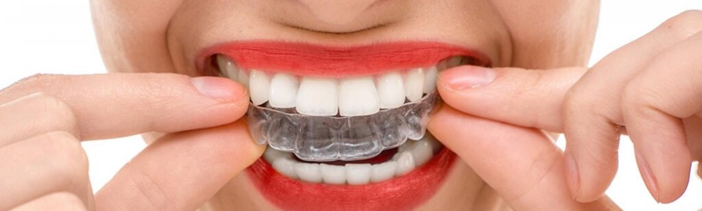 A person holding her Invisalign Clear Aligners