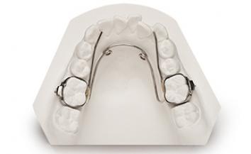 Image of how a dentofacial device fits behind the teeth.