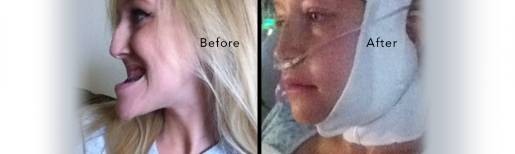 A photo of a patient before and after having surgery.