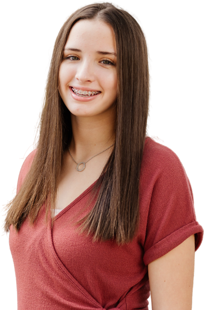 Same Day Braces Tampa Bay East Bradenton Blue Wave Orthodontics